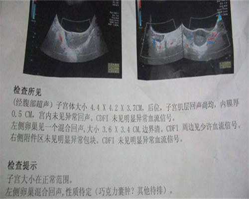 <strong>孕妇能喝黑枸杞水吗</strong>