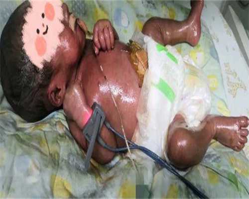 广州包性别代生套餐，广州供卵机构包男孩（广州代生男宝）