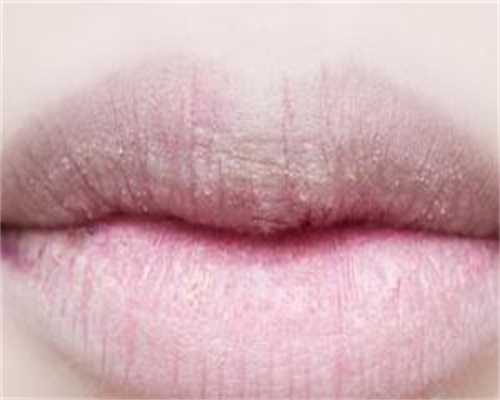 广州代生子好不好，广州去狐臭哪个医院好