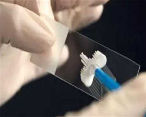 广州捐卵途径，广州瘦小腿去哪家医美整形医院好？