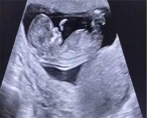 广州有没有代怀的公司，广州供卵公司(甘南州供卵公司)