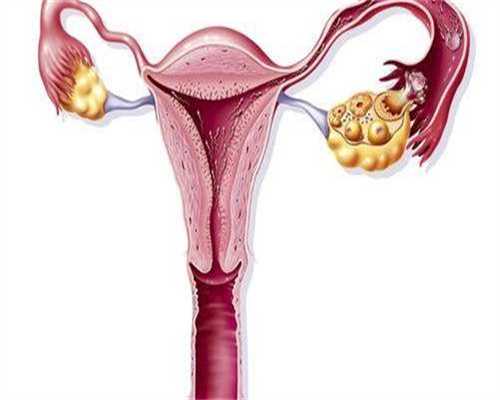 ​女性下腹部坠胀的原因是什么？