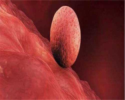 广州代生的花费，广州祛斑医院哪家好