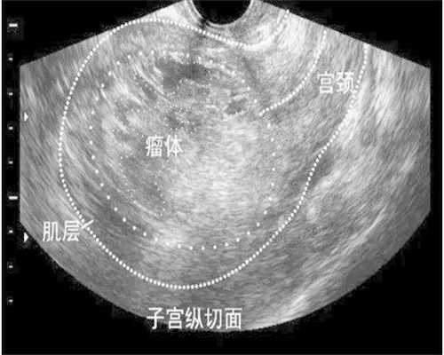 广州怎么代生孩子-广州试管代生男孩的基本流程