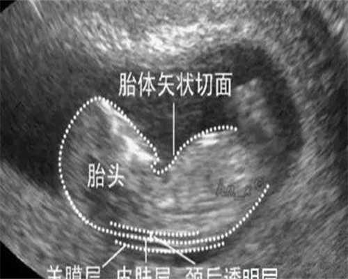 代生公司正规：广州妇幼保健院做试管婴儿怎么样？一次试管费用多少？