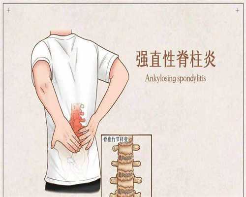 东莞代孕qq群个人-广东中山试管代孕中心