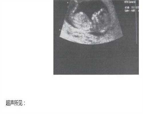 广州供卵试管费用大概是多少钱啊，广州供卵供精一起做的试管可以去哪家机构