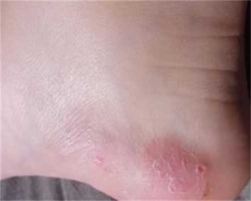 南京三代试管婴儿选性别要多少钱-正规试管供卵机构