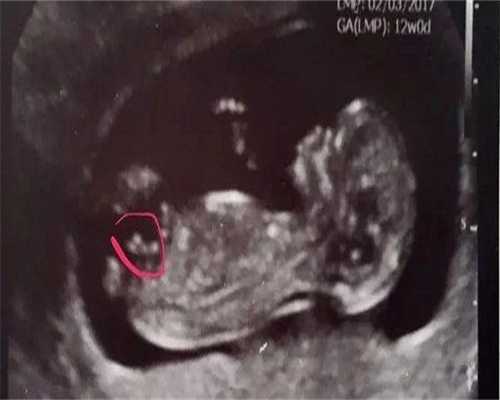 广东找人代生，广州添丁助孕国际管理咨询有限公司