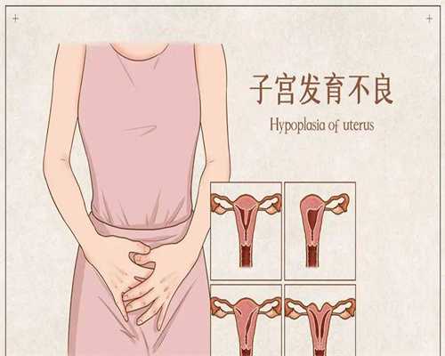 东莞代孕生子价格-广东中山试管代孕中心