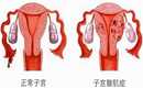 广州代生小孩子，广州卧蚕再造哪个医院好
