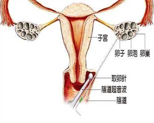 广州的合法供卵，广州哪家医院做光子嫩肤好