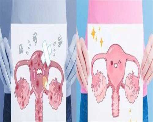 广州代孕比较好的医院（附试管生双胞胎条件指南）