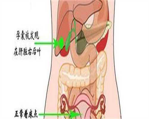广州代生办理，广州做唇裂修复好的医院有哪些?