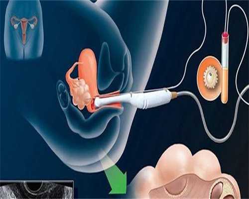 东莞代孕靠不靠谱呢-广东中山试管代孕中心