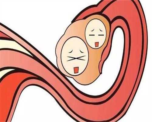 代孕产子流程：女性结扎手术怎么做-女性结扎手术疼吗