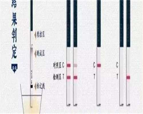 广州代怀好吗，广州治疗脱发哪家美容整形医院效果好？