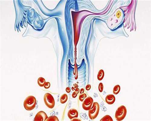 广州代生QQ群，广州疤痕去除哪家好