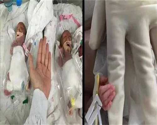 武汉代怀孕助孕方案，广州好孕试管,武汉助孕