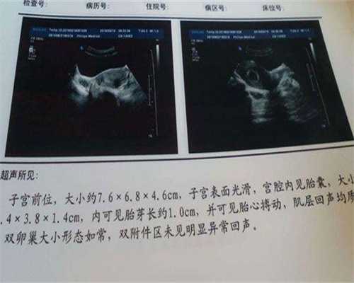 广州急找个女人代怀，广州第三代试管婴儿