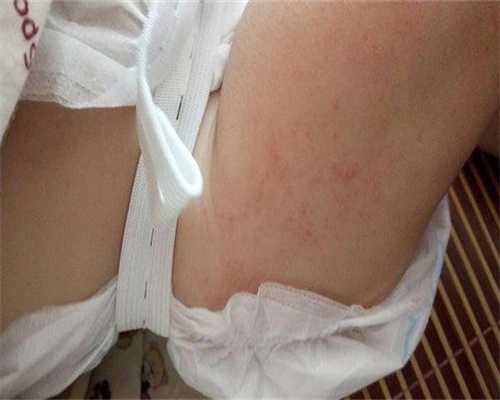 扬州三代试管可以保证染色体不出问题吗