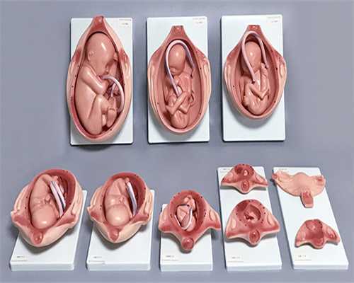 2026广州代生小孩价格，广州疤痕去除哪家好