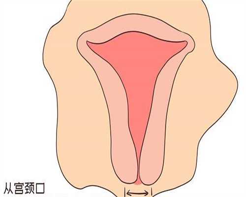 广州代生孩子包成功，俄罗斯试管婴儿有包成功的吗(广州试管婴儿包成