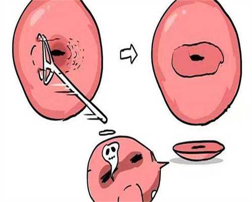 上海供卵代怀（成都试管代生）