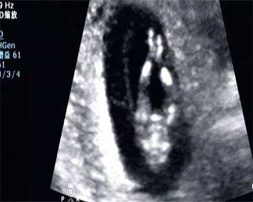 广州代生真实吗- 广州代生医院简介