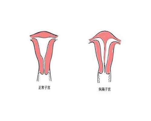 杭州医院有无偿供卵吗,供卵包男孩热点金摇篮生子,广州借卵包男孩去找金摇篮