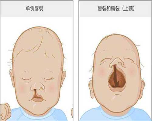 广州代孕最新价格表-广州代孕中心排名