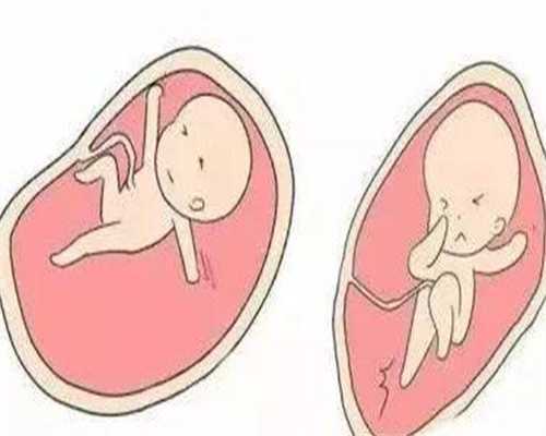 <strong>代生要多少钱：无创dnaplus能查什么病？无创dnaplus能查哪100项疾病</strong>