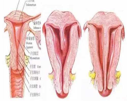 代生公司价格：34岁一侧囊肿直径6.2cm，卵巢囊肿的治疗方法有哪些？