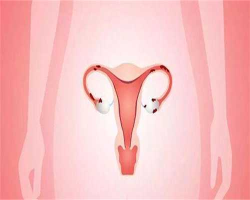 广州助孕怎么收费(100%包成功)