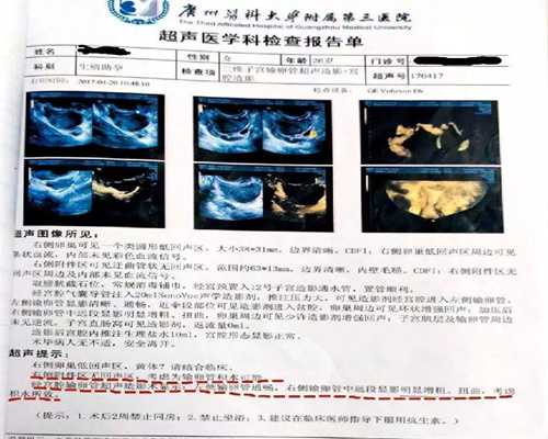 未婚女性可以做混血试管婴儿吗