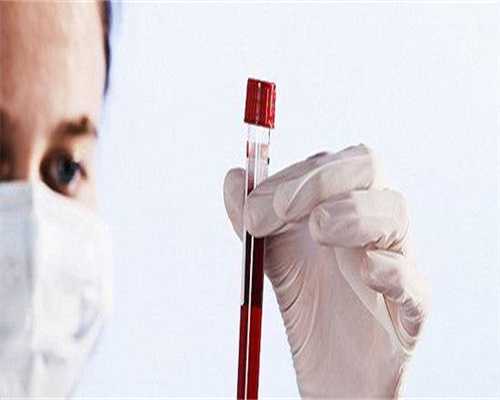 广州哪家医院可做供卵试管，广州做唇裂修复好的医院有哪些?