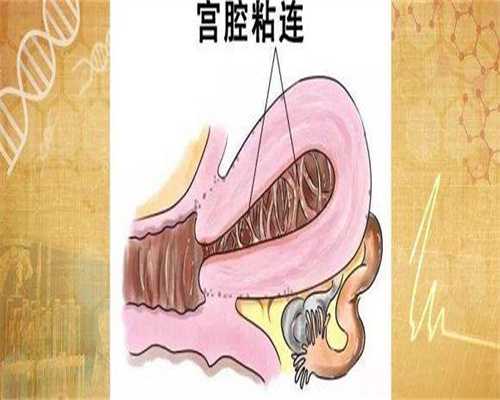 怎么找广州借腹生子中心，广州助孕机构-广州辅助生殖中心