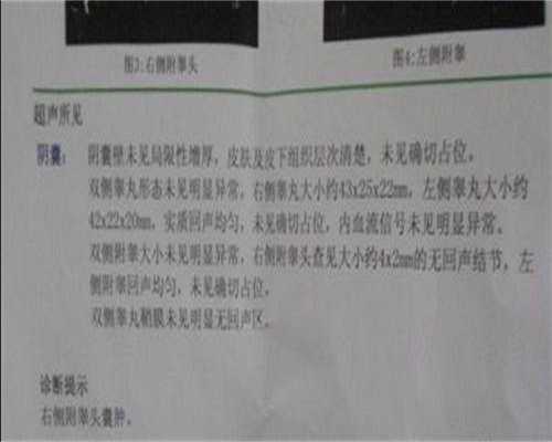 去深圳做试管的成功率高吗，广东做试管的成功几率解析