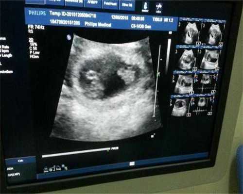 广州代生流程与费用，【广州试管婴儿】广州做试管婴儿费用、流程