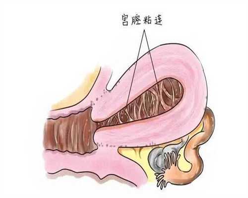 广州代生哪个做最好，广州做三代试管最好的医院,广州第三代试管哪家好