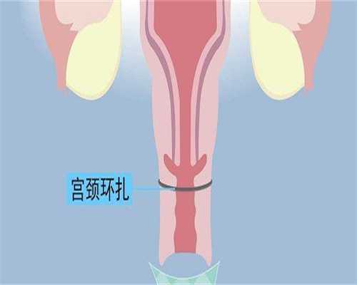 广州助孕冯医生，广州试管代怀（广州助孕）