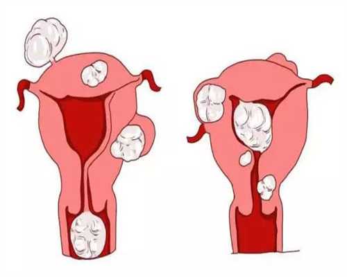 广东借卵生子机构，借卵生子是什么意思
