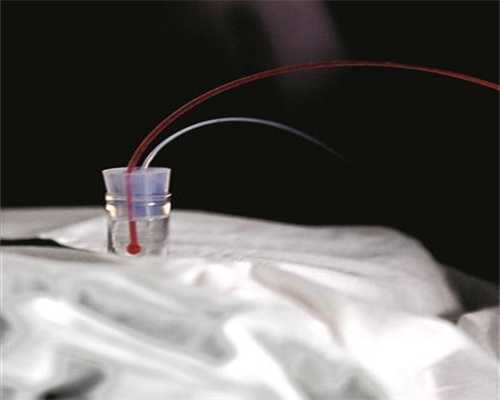 去广东捐卵，广东供卵手术医院,广东供卵试管婴儿医院