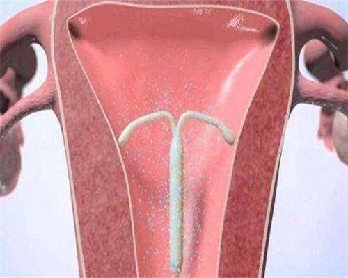 广州在哪里可以做供卵试管（借卵正规医院）