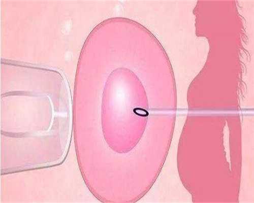 广州代生公司有吗，广州传承生殖