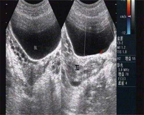 广州试管代生费，广州试管婴儿费用大概多少钱?广州试管婴儿成功率是多少?