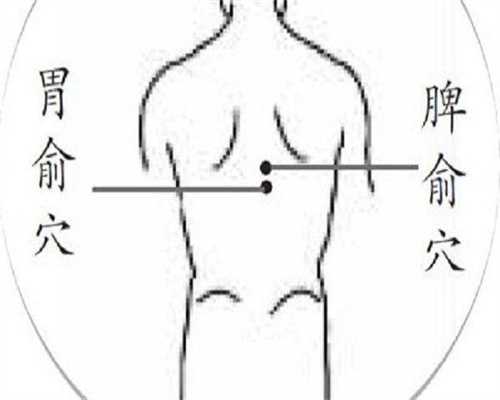 广州哪里助孕好