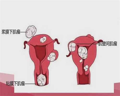 广州代生子qq群，广州三甲医院植发多少钱