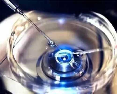 广州供卵医院：高龄做试管适合什么方案，怎么提升卵子质量？