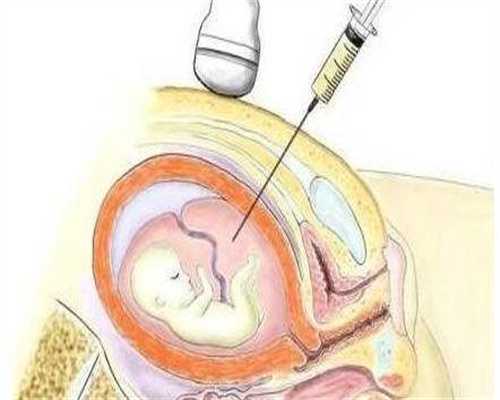 广州代孕机构价格表-广州世纪代孕价格表